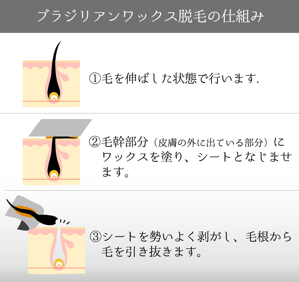 ブラジリアンワックス脱毛の仕組み ①毛を伸ばした状態で行います。②毛幹部分にワックスを塗り、シートとなじませます。③シートを勢いよく剥がし、毛根から毛を引き抜きます。